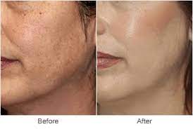 Trusted Skin Specialist in Vijay Nagar, Indore